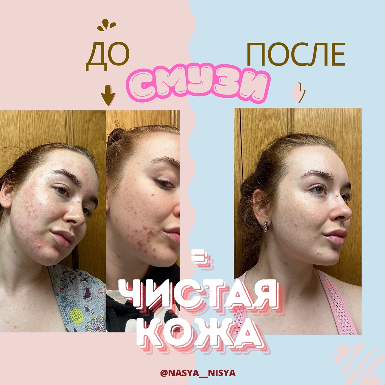 До/после: улучшение кожи